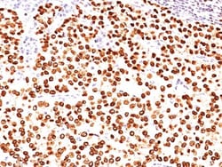 Progesterone R/NR3C3 Antibody (PR484), Novus Biologicals 0.2mg; Unlabeled:Antibodies,