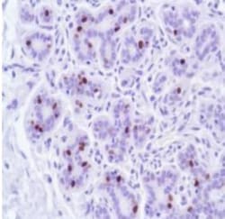 Progesterone R/NR3C3 Antibody (SP42), Novus Biologicals 0.1 mL | Buy Online | Novus Biologicals | Fisher Scientific