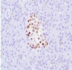 Progesterone R/NR3C3 Antibody (SP42), Novus Biologicals 0.1 mL | Buy Online | Novus Biologicals | Fisher Scientific