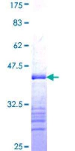 Novus Biologicals Recombinant Human Progesterone R/NR3C3 GST (N-Term) Protein 25 &mu;g | Buy Online | Novus Biologicals&trade; | Fisher Scientific