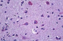 Prokineticin R2/PROKR2 Antibody, Novus Biologicals 0.1mg; Unlabeled:Antibodies,