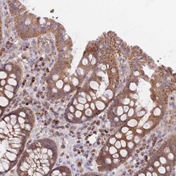 Prolyl Oligopeptidase/PREP Antibody, Novus Biologicals 25 &mu;L, Unlabeled:Antibodies,