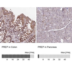 Prolyl Oligopeptidase/PREP Antibody, Novus Biologicals 25 &mu;L, Unlabeled:Antibodies,