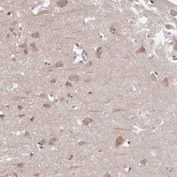 Prolyl endopeptidase-like Antibody, Novus Biologicals:Antibodies:Primary