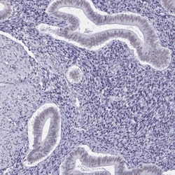 PSP94/MSMB Antibody, Novus Biologicals 0.1mL; Unlabeled:Antibodies, Polyclonal
