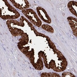 PSP94/MSMB Antibody, Novus Biologicals 0.1mL; Unlabeled:Antibodies, Polyclonal