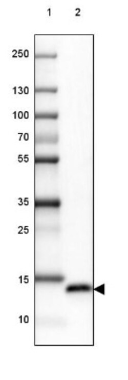 PSP94/MSMB Antibody, Novus Biologicals 0.1mL; Unlabeled:Antibodies, Polyclonal