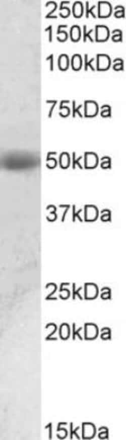 Prostatic Acid Phosphatase/ACPP Antibody, Novus Biologicals 0.1mg; Unlabeled:Antibodies,