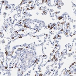 Prosurfactant Protein C Antibody, Novus Biologicals 0.1mL; Unlabeled:Antikörper