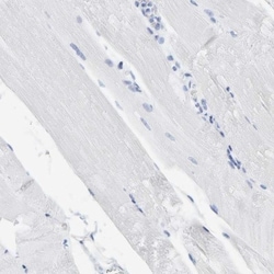 Prosurfactant Protein C Antibody, Novus Biologicals 0.1mL; Unlabeled:Antikörper