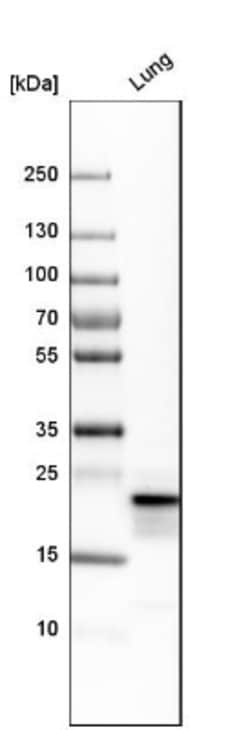 Prosurfactant Protein C Antibody, Novus Biologicals 0.1mL; Unlabeled:Antikörper