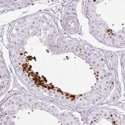 Protamine 1 Antibody, Novus Biologicals:Antibodies:Primary Antibodies