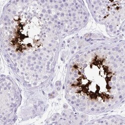 Protamine 2 Antibody, Novus Biologicals 25 &mu;L | Buy Online | Novus Biologicals | Fisher Scientific
