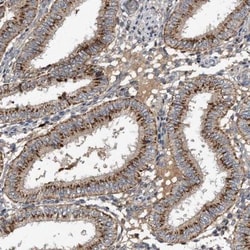 Protease Inhibitor 15 Antibody, Novus Biologicals 0.1mL; Unlabeled:Antibodies,