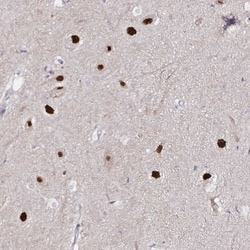 Proteasome 19S S3 Antibody, Novus Biologicals 25 &mu;L, Unlabeled:Antibodies,