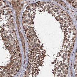 S5a/Angiocidin Antibody, Novus Biologicals 0.1mL; Unlabeled:Antibodies,