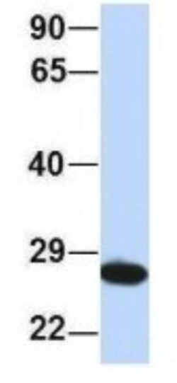 PSMA2 Antibody, Novus Biologicals 100&mu;L; Unlabeled:Antibodies, Polyclonal