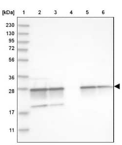USP1 Antibody, Novus Biologicals:Antibodies:Primary Antibodies