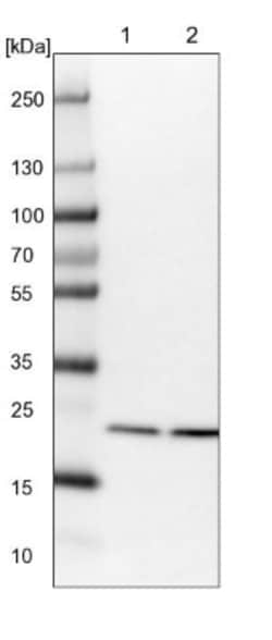 Proteasome 20S beta2 Antibody, Novus Biologicals 0.1mL; Unlabeled:Antibodies,