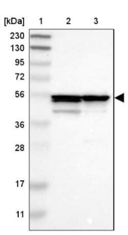 Proteasome 26S S5 Antibody, Novus Biologicals:Antibodies:Primary Antibodies