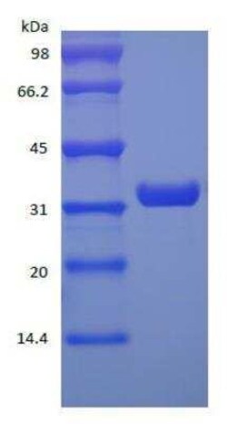 Novus Biologicals Recombinant Protein A Cys (C-Term) Protein 10 mg | Buy Online | Novus Biologicals&trade; | Fisher Scientific