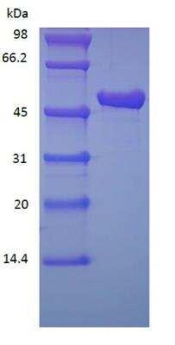 Novus Biologicals Recombinant Protein A/G Cys (C-Term) Protein 1 mg | Buy Online | Novus Biologicals&trade; | Fisher Scientific