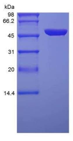 Novus Biologicals Recombinant Protein A/G Protein 100 mg | Buy Online | Novus Biologicals&trade; | Fisher Scientific