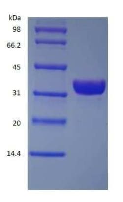 Novus Biologicals Recombinant Protein A His (C-Term) Protein 100 mg | Buy Online | Novus Biologicals&trade; | Fisher Scientific