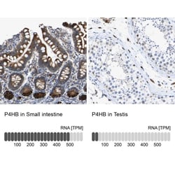 Protein Disulfide Isomerase/P4HB Antibody, Novus Biologicals:Antibodies:Primary