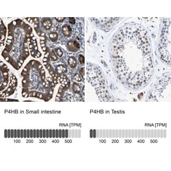 Protein Disulfide Isomerase/P4HB Antibody, Novus Biologicals:Antibodies:Primary