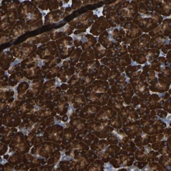 Protein Disulfide Isomerase/P4HB Antibody, Novus Biologicals:Antibodies:Primary