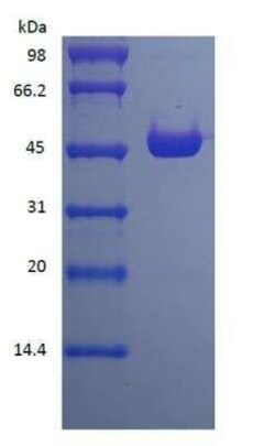 Novus Biologicals Recombinant Protein L Type 1 His (N-Term) Cys (C-Term) Protein 1 mg | Buy Online | Novus Biologicals&trade; | Fisher Scientific