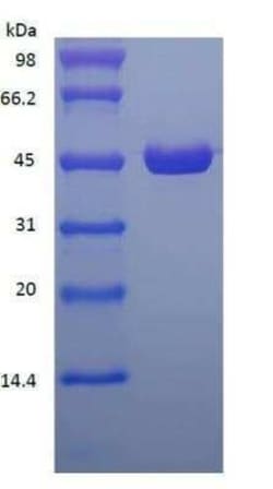 Novus Biologicals&trade;&nbsp;Recombinant Protein L Type 1 Protein