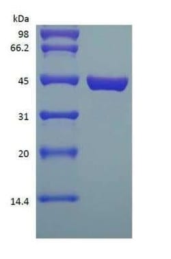 Novus Biologicals&trade;&nbsp;Recombinant Protein L Type 1 Protein