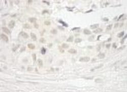 Protein Phosphatase 1 beta Antibody, Novus Biologicals 0.1mL; Unlabeled:Antibodies,