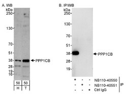 Protein Phosphatase 1 beta Antibody, Novus Biologicals 0.1mL; Unlabeled:Antibodies,