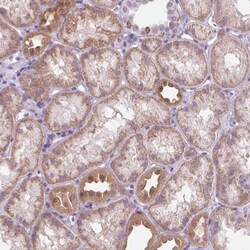Protein Phosphatase inhibitor 1 Antibody, Novus Biologicals 25 &mu;L, Unlabeled:Antibodies,