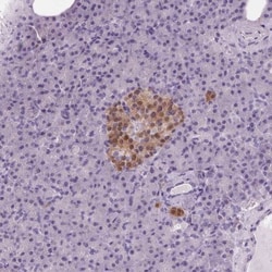 Protein Phosphatase inhibitor 1 Antibody, Novus Biologicals 25 &mu;L, Unlabeled:Antibodies,