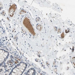 Protein S/PROS1 Antibody, Novus Biologicals 0.1mL; Unlabeled:Antibodies,