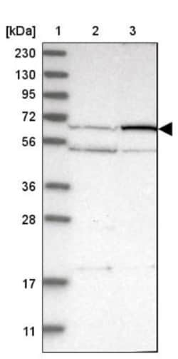 Protein S/PROS1 Antibody, Novus Biologicals 0.1mL; Unlabeled:Antibodies,