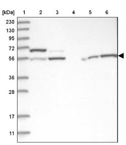 Protein phosphatase 1F Antibody, Novus Biologicals 0.1mL; Unlabeled:Antibodies,