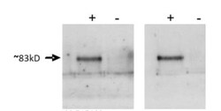 Prox1 Antibody, Novus Biologicals 0.2 mg; Unconjugated:Antibodies, Polyclonal