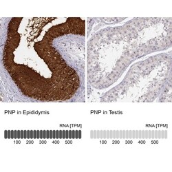 Purine Nucleoside Phosphorylase/PNP Antibody, Novus Biologicals:Antibodies:Primary