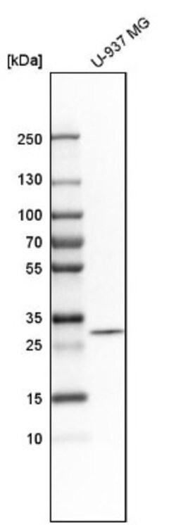 Purine Nucleoside Phosphorylase/PNP Antibody, Novus Biologicals:Antibodies:Primary