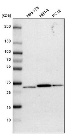 Purine Nucleoside Phosphorylase/PNP Antibody, Novus Biologicals:Antibodies:Primary