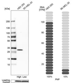 Purine Nucleoside Phosphorylase/PNP Antibody, Novus Biologicals:Antibodies:Primary