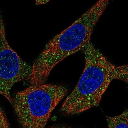 Puromycin-sensitive aminopeptidase/NPEPPS Antibody, Novus Biologicals:Antibodies:Primary