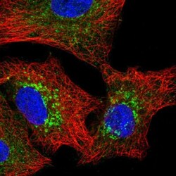 Pyruvate Carboxylase Antibody, Novus Biologicals 0.1mL; Unlabeled:Antibodies,