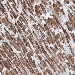 Pyruvate Dehydrogenase E1 beta subunit Antibody, Novus Biologicals 0.1mL;