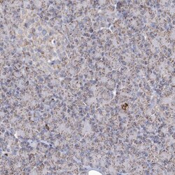 Pyruvate Dehydrogenase E1 beta subunit Antibody, Novus Biologicals 0.1mL;